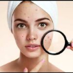 Skin Care Tips: त्वचा के दाग धब्बों की समस्या से छुटकारा पाने के लिए बेहद असरकारक है पपीते का तेल !