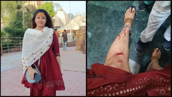 Tanushree Dutta Accident: मंदिर जाते समय इस एक्ट्रेस का हुआ Accident, शेयर की तस्वीरें