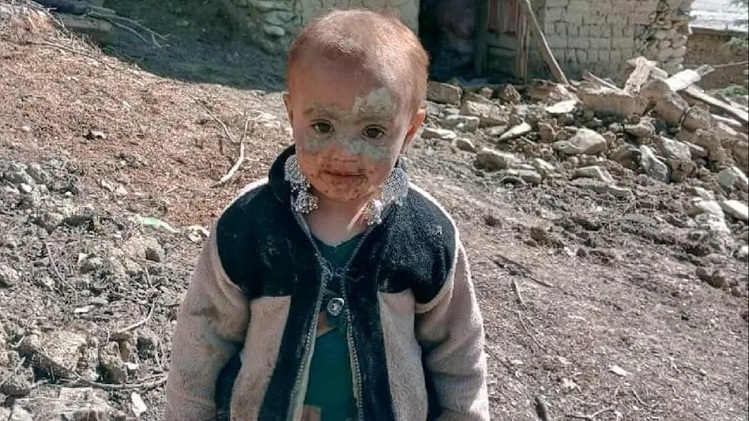 भूकंप से परिवार के सारे लोग मारे गए, अकेली बची नन्हीं बच्ची की तस्वीर हुई वायरल