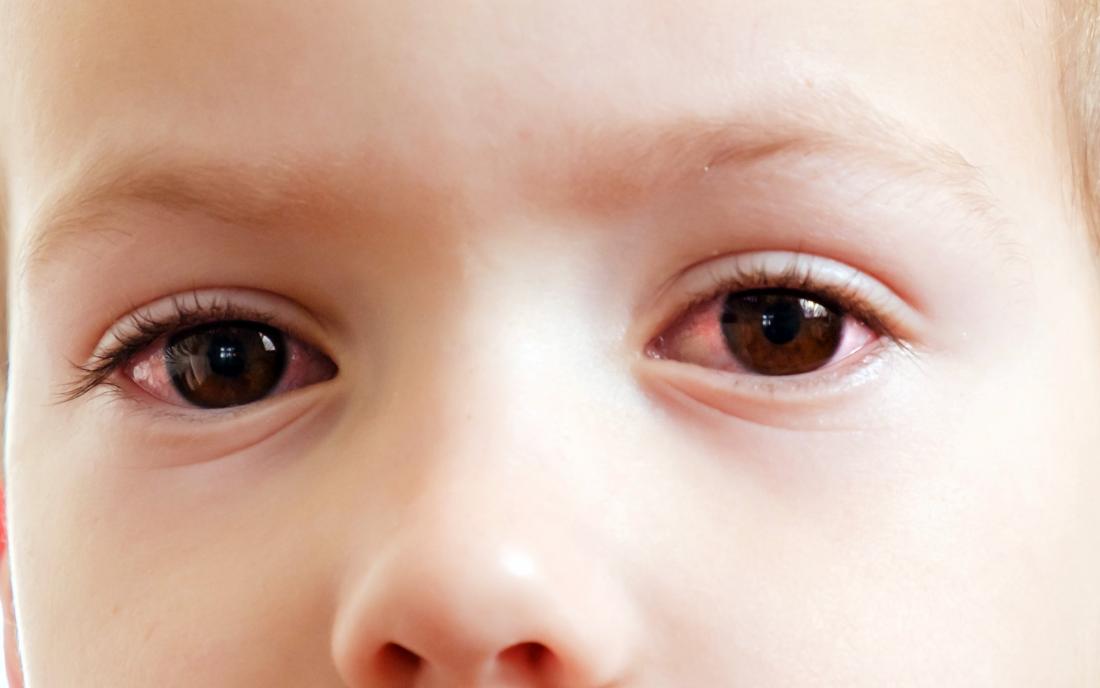 Health Care Tips: बच्चों में बढ़ती आंखों की समस्या से राहत के लिए पेरेंट्स फॉलो करें ये टिप्स !