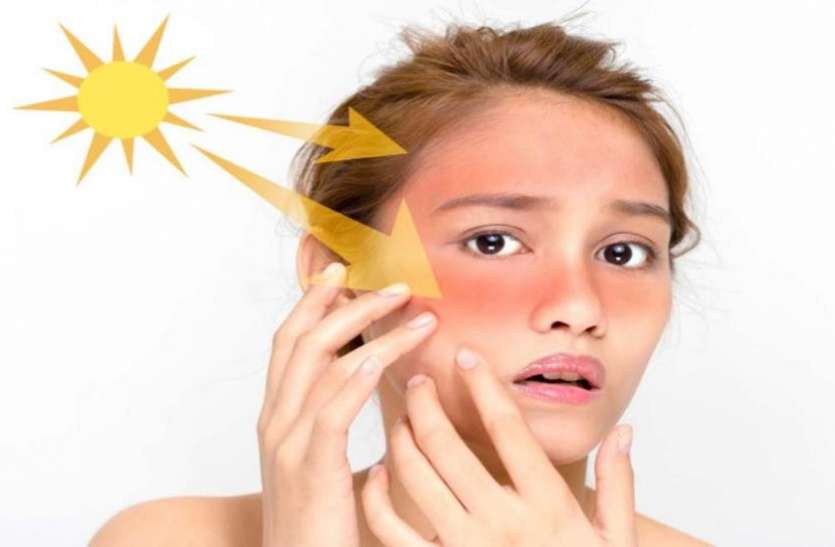 Skin Care Tips: सर्दियों में त्वचा पर होने वाली टैनिंग को दूर करने के लिए अपनाएं ये आसान तरीके !