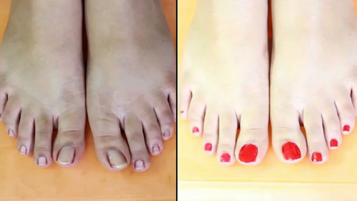 Feet Care Tips: पैरों के कालेपन को दूर करने के लिए अपनाएं यह घरेलू नुस्खे, आइए जानें !