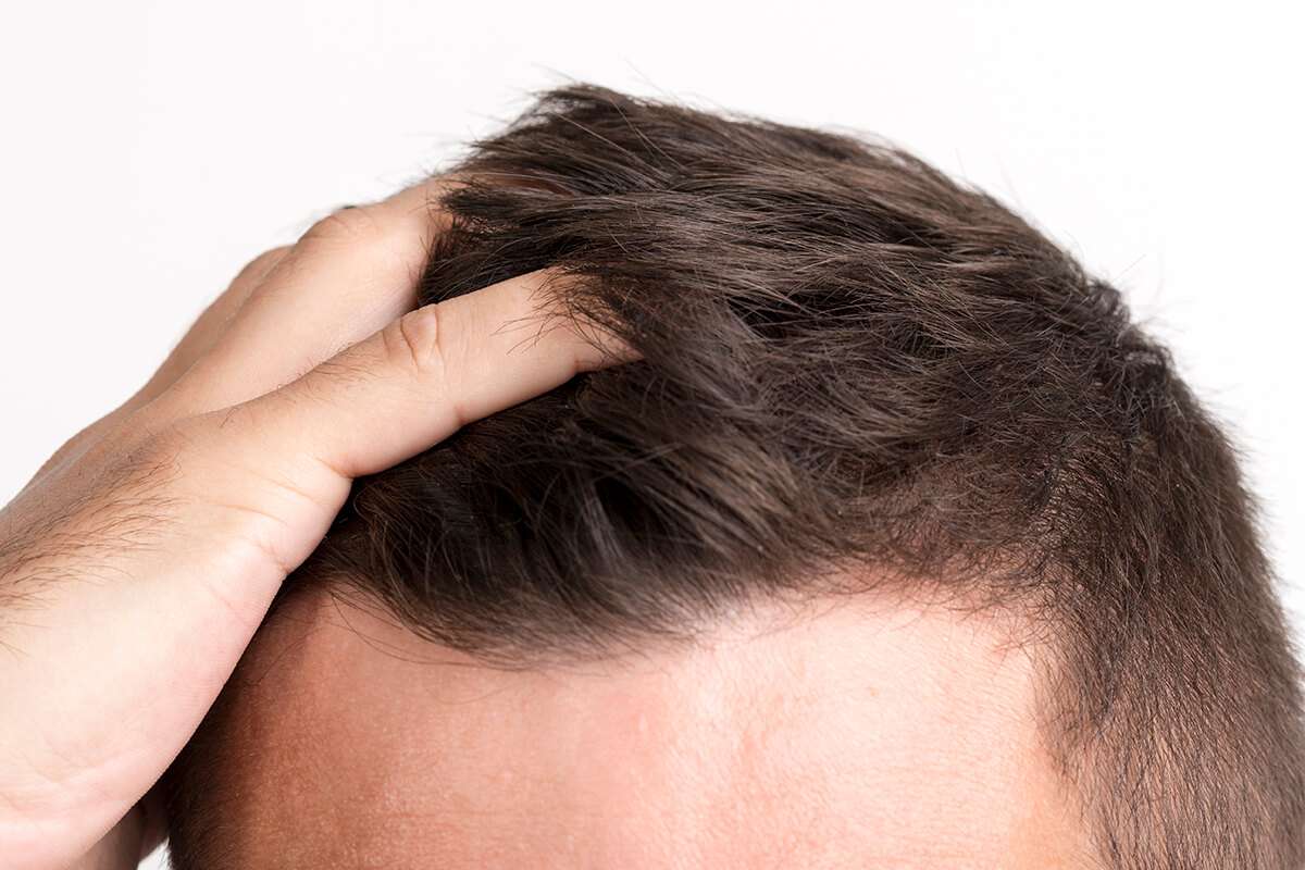 Hair Care Tips: गंजेपन का शिकार होने से बचने के लिए पुरुष अपने इन आदतों से आज से ही करें तोबा !