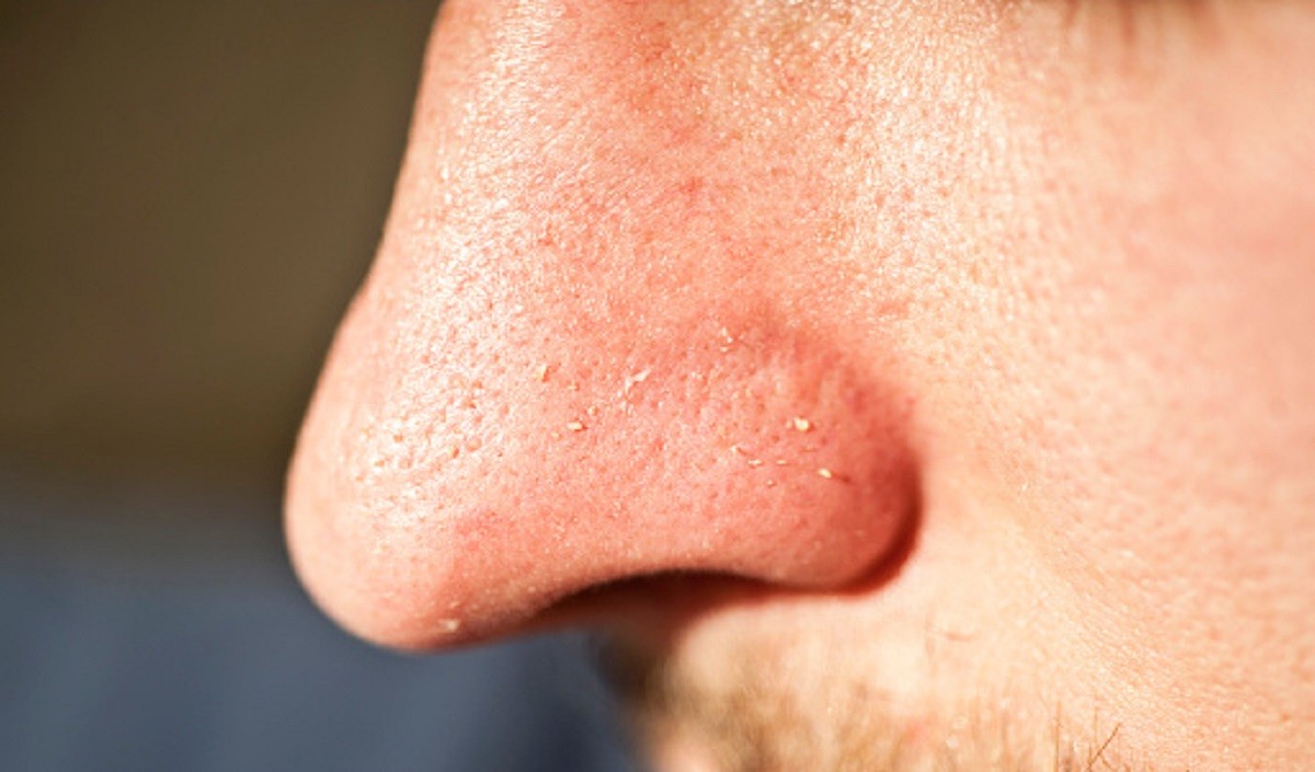 Skin Care Tips: चेहरे पर होने वाले जिद्दी व्हाइटहेड्स को दूर करने के लिए ओट्स का इस तरह करें इस्तेमाल !