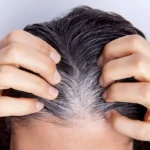 Beauty Care Tips: आप भी है चेहरे पर आने वाले सफेद बालों से परेशान तो राहत पाने के लिए करे ये उपाय !