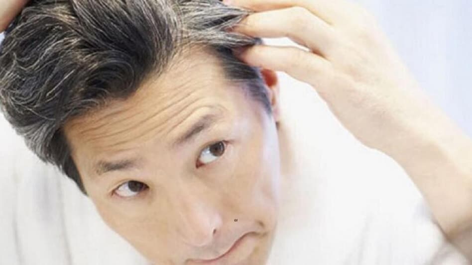Hair Care Tips: सफेद बालों की समस्या से राहत पाने के लिए करें ये आसान उपाय !