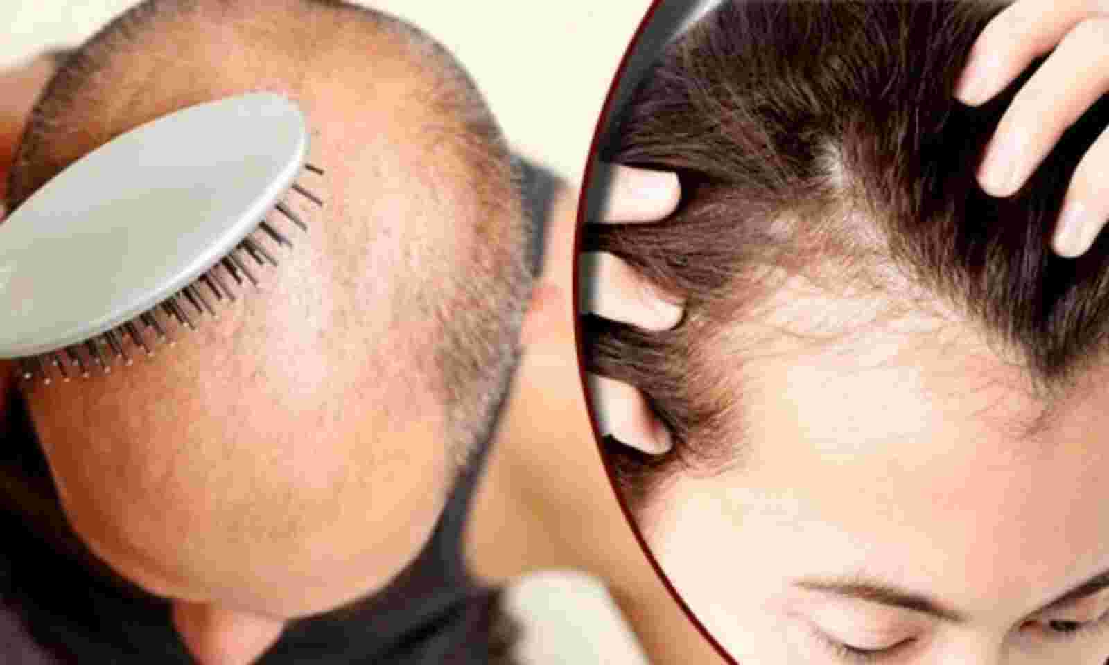 Hair Care Tips: बाल झड़ने और गंजेपन की समस्या से बचे रहने के लिए आज से ही डाइट में शामिल करें ये फूड्स !