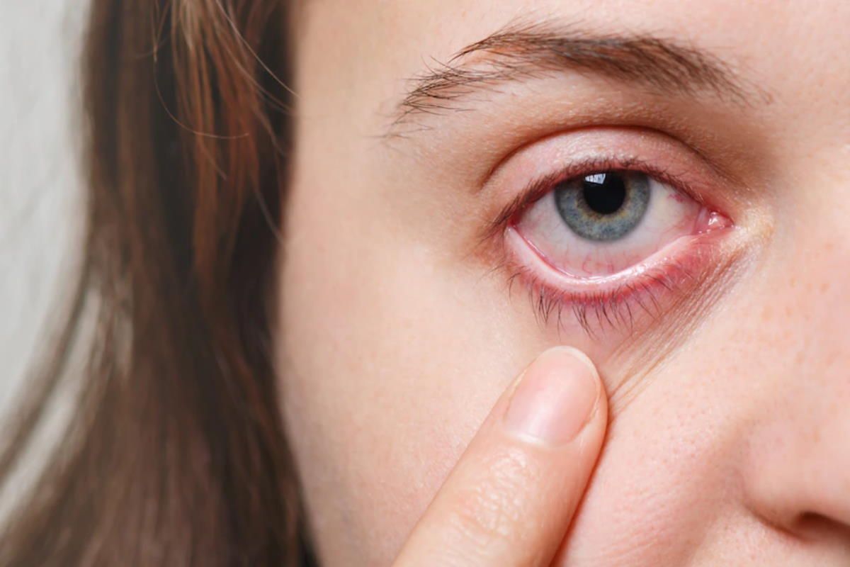 Health Care Tips: आंखों में खुजली और सूखे पन की समस्या से है परेशान तो राहत के लिए अपनाएं ये घरेलू उपाय !