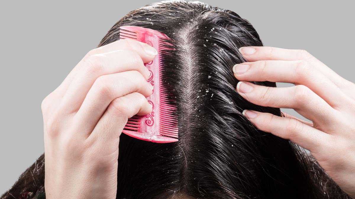 Hair Care Tips: हो जाए सावधान, आपकी इन गलतियों की वजह से बालों में हो सकता है डैंड्रफ !