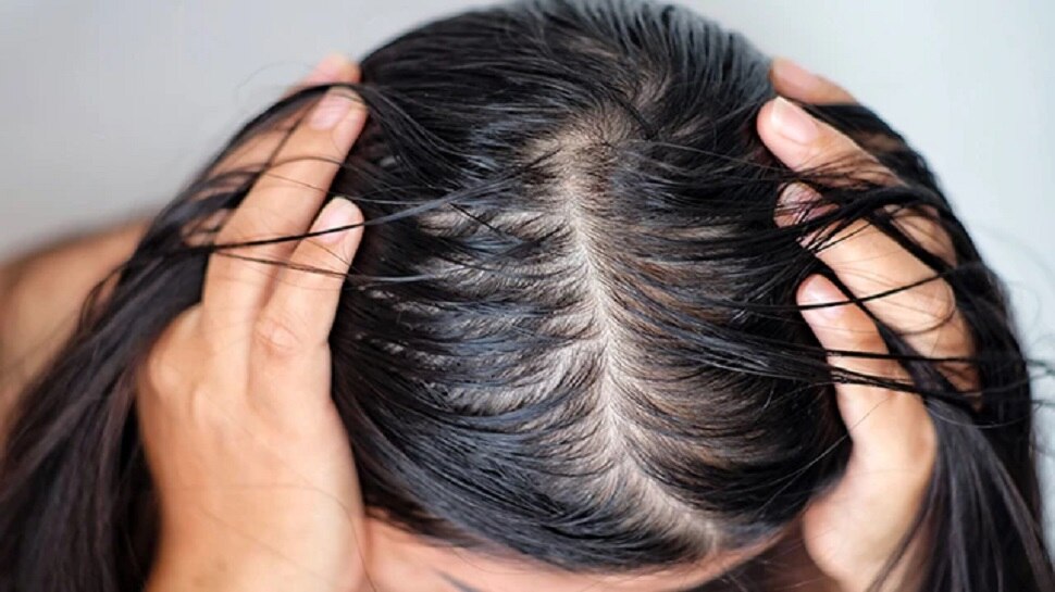 Hair Care Tips: गर्मियों में बालों की चिपचिपाहट से राहत पाने के लिए अपनाएं ये तरीके, बाल होंगे सिल्की और खूबसूरत !