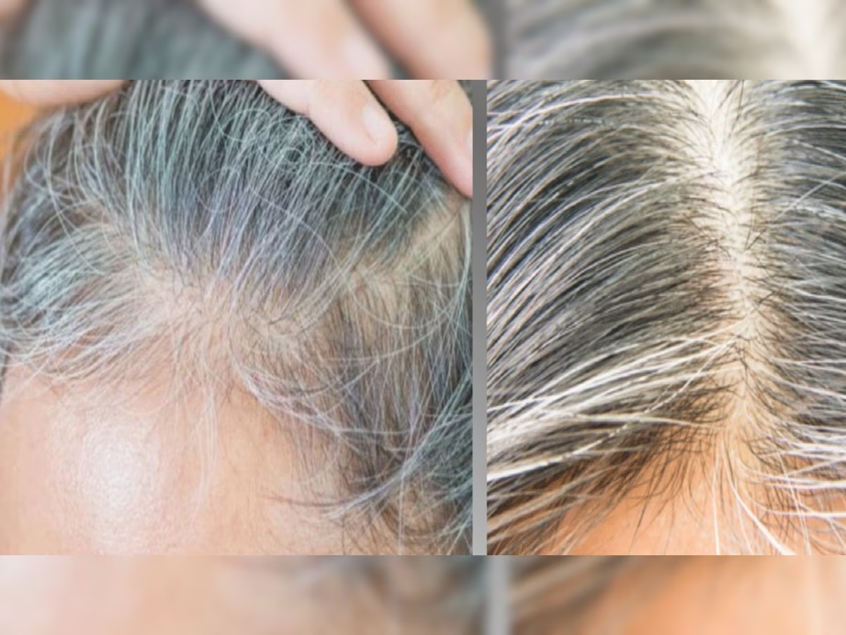 Hair Care Tips: सफेद बालों की समस्या से राहत पाने के लिए अपनाएं नारियल तेल से जुड़ा ये उपाय !
