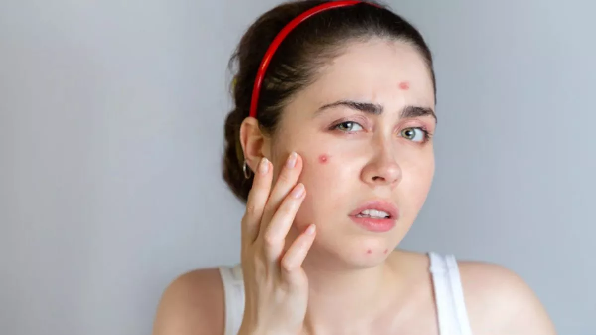 Skin Care Tips: कील मुहांसों और झाइयों की समस्या को जड़ से खत्म करने के लिए इस तरह करें तुलसी का इस्तेमाल !
