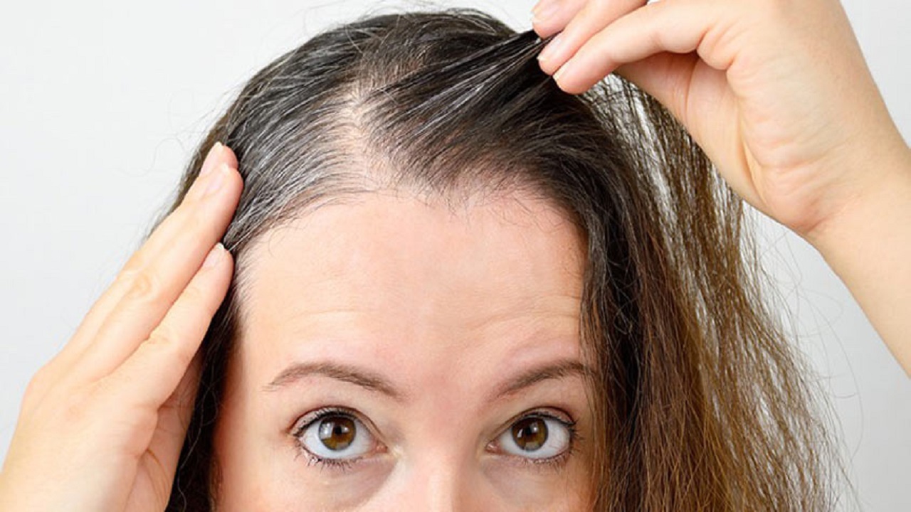 Hair Care Tips: बाल सफेद होने के पीछे इस विटामिन की कमी भी हो सकती है कारण, इस तरह पाए राहत !