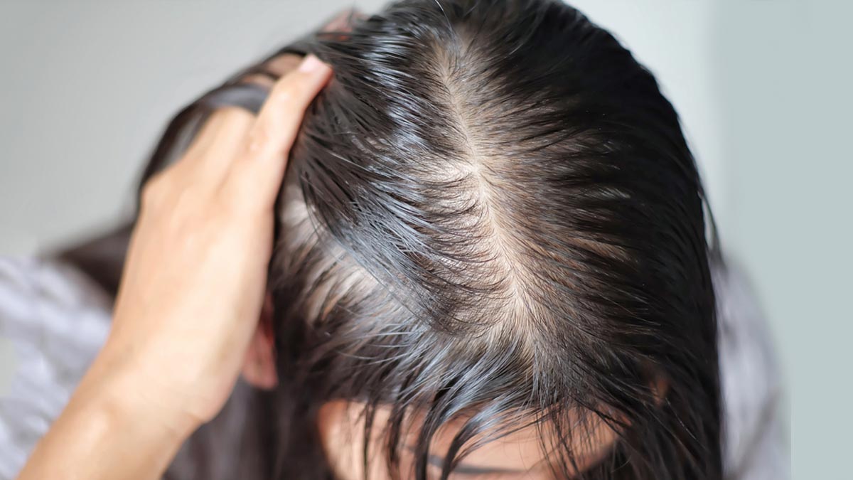 Health Care Tips: शरीर में बायोटीन की कमी की वजह से झड़ने लगते हैं आपके बाल, पूर्ति के लिए इन फूड्स का करें सेवन !