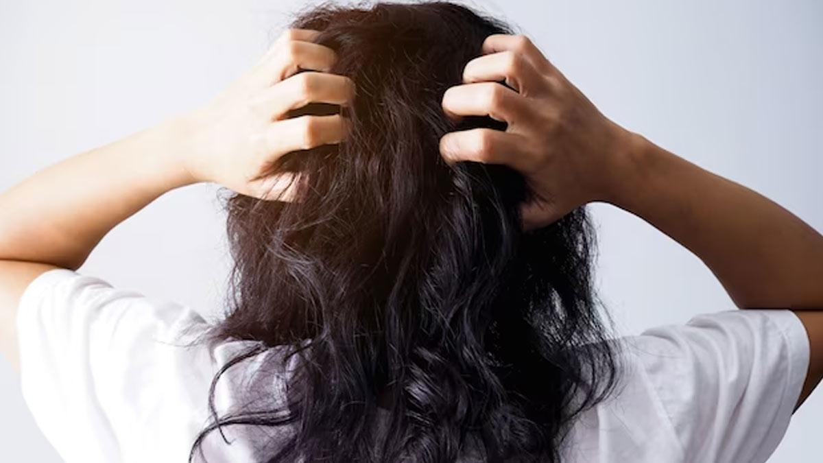 Hair Care Tips: सिर में होने वाली खुजली और डेंड्रफ की समस्या से राहत पाने के लिए दही का इस तरह करें इस्तेमाल !
