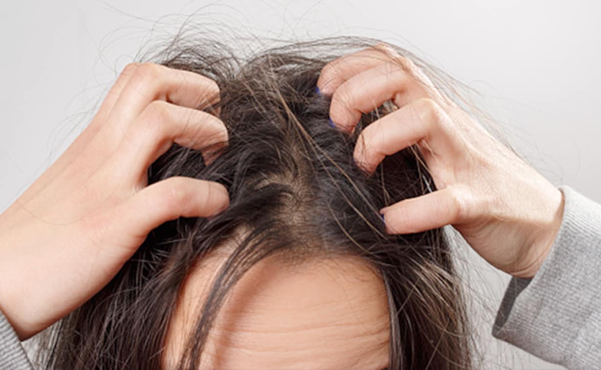 Hair Care Tips: बरसात में बालों में होने वाली खुजली की समस्या से राहत के लिए इन हेयर मास्क का करें इस्तेमाल !