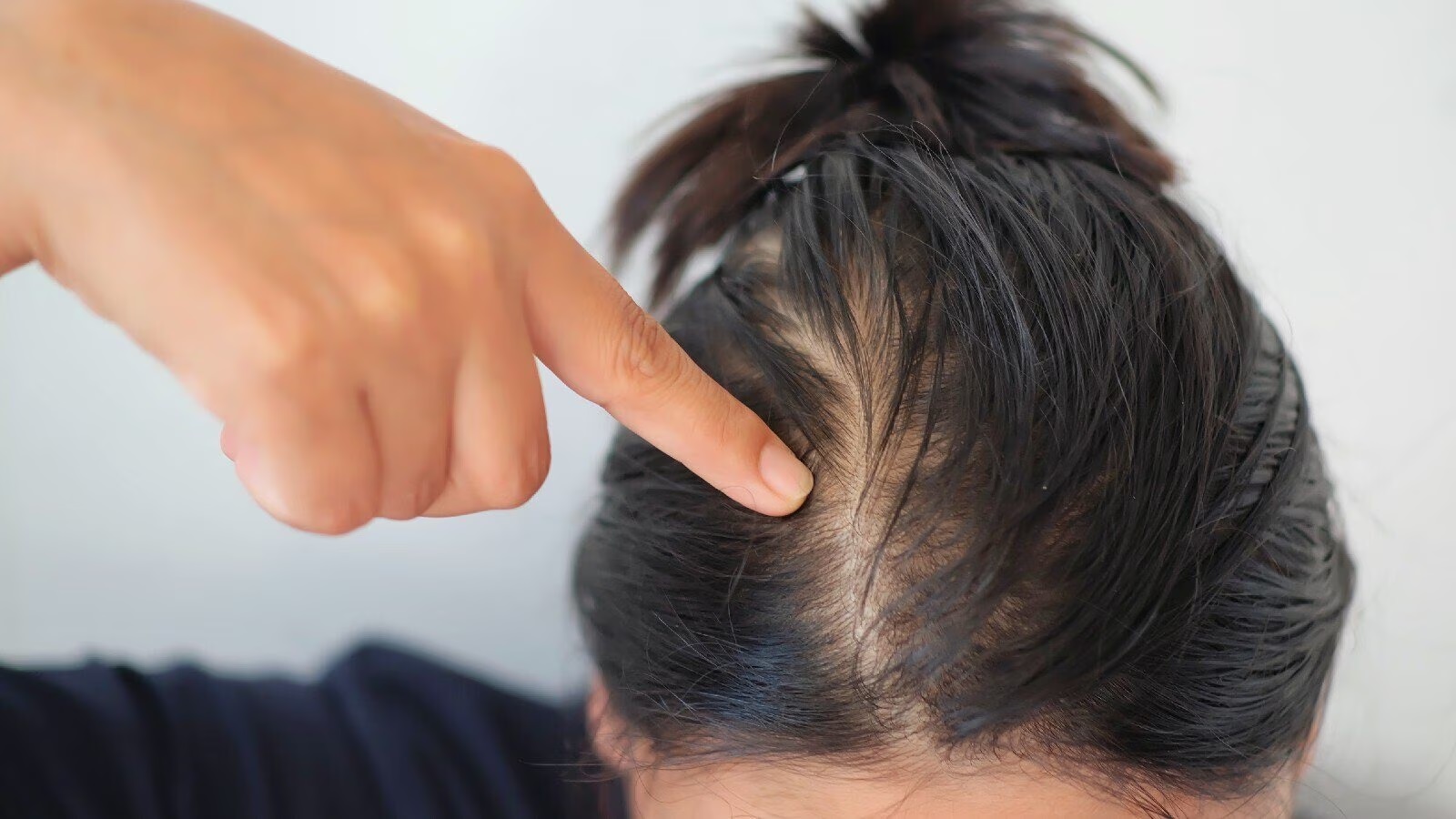 Hair Care Tips: बालों से जुड़ी हर समस्या का कारगर इलाज है एलोवेरा, इस तरह बनाए हेयर मास्क !