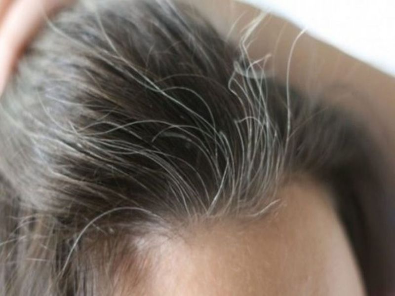 Hair Care Tips: कम उम्र में सफेद बालों की वजह से होना पड़ता है शर्मिंदा, राहत के लिए अपनाएं ये तरीके !