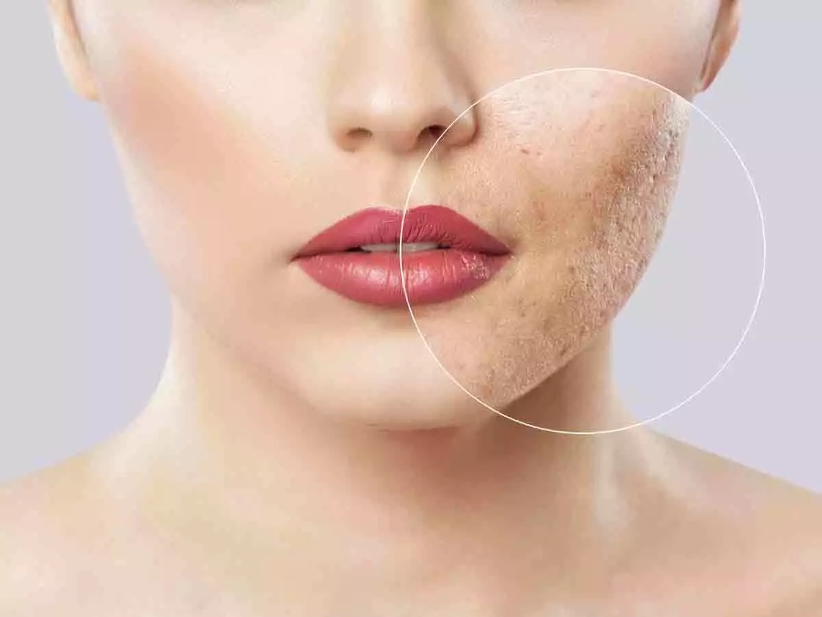 Skin Care Tips: चेहरे पर होने वाले दाग धब्बों को दूर करने के लिए मुल्तानी मिट्टी का इस तरह करें इस्तेमाल !